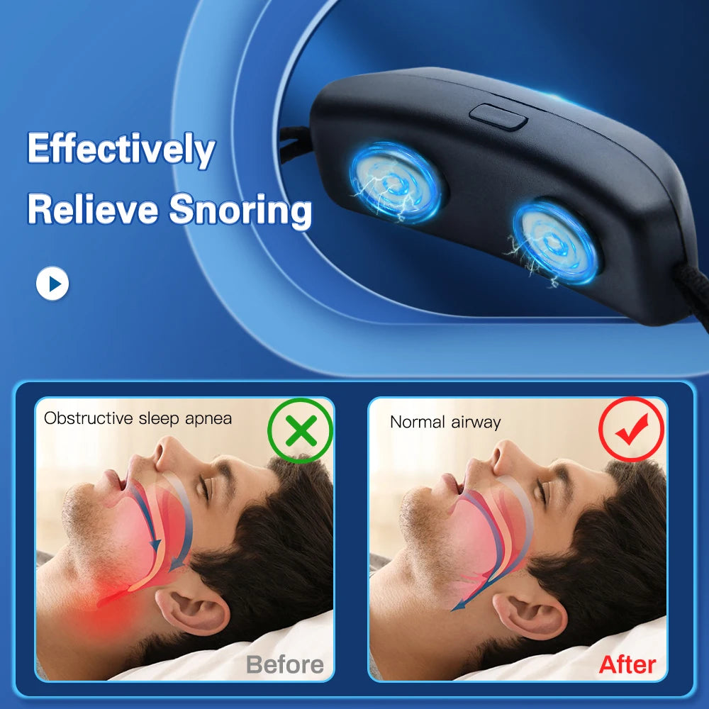 EMS Pulse Stop Snore &ndash; USB Smart Comfortable Sleep Aid