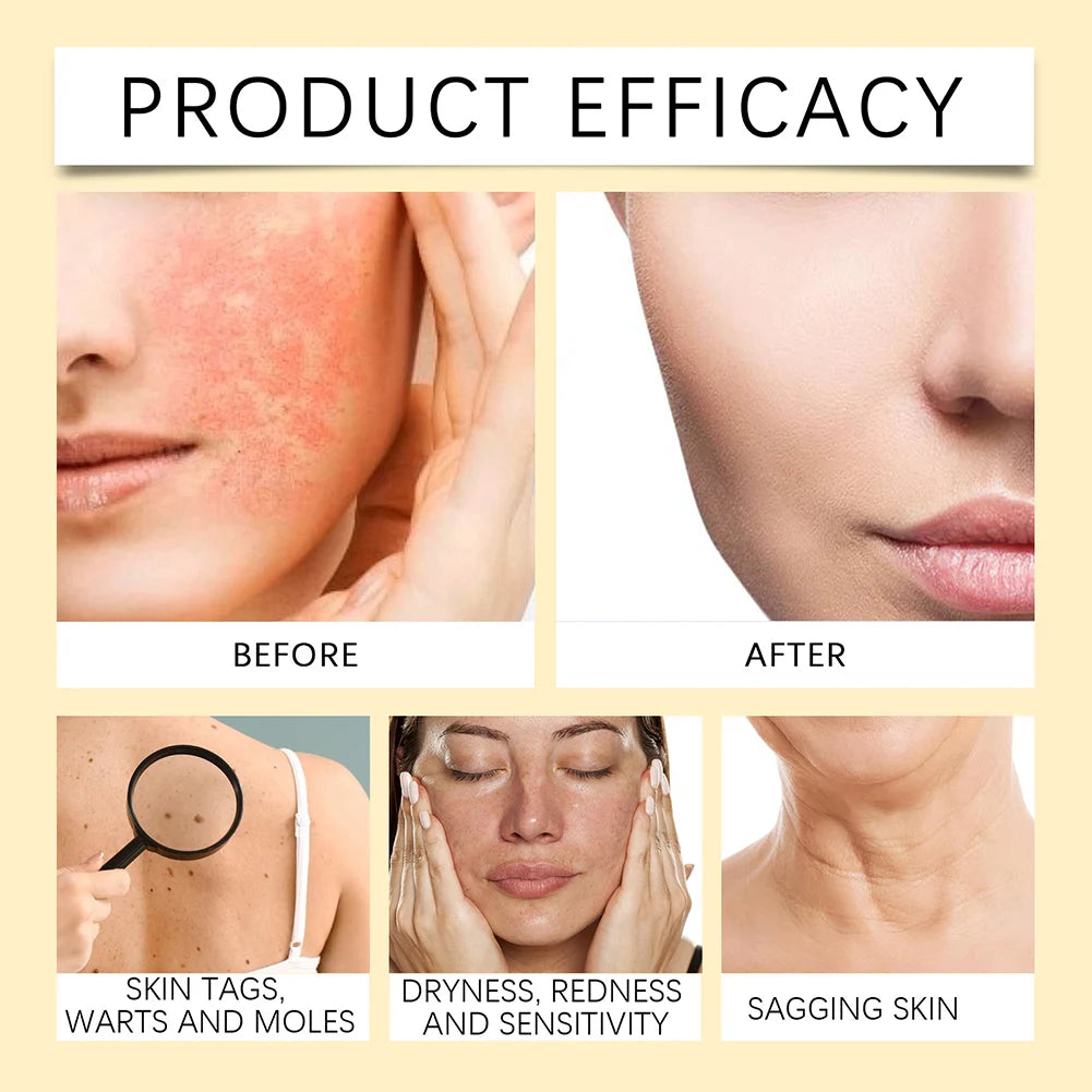 Bee-Venom Treatment Cream &ndash; Powerful Anti-Aging Solution