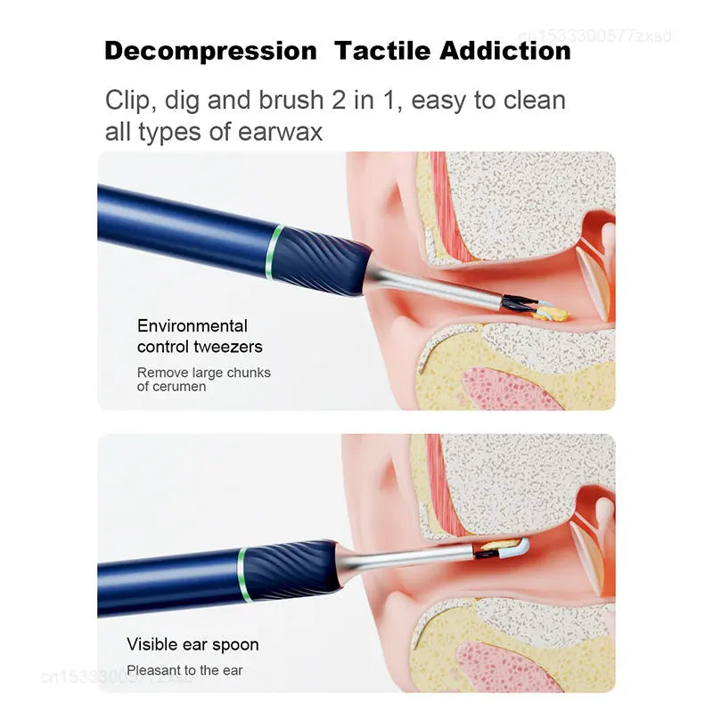 Bebird Note5 Pro Έξυπνος Οπτικός Ενδοσκόπιος Ωτός 1000W Ακουστικό 