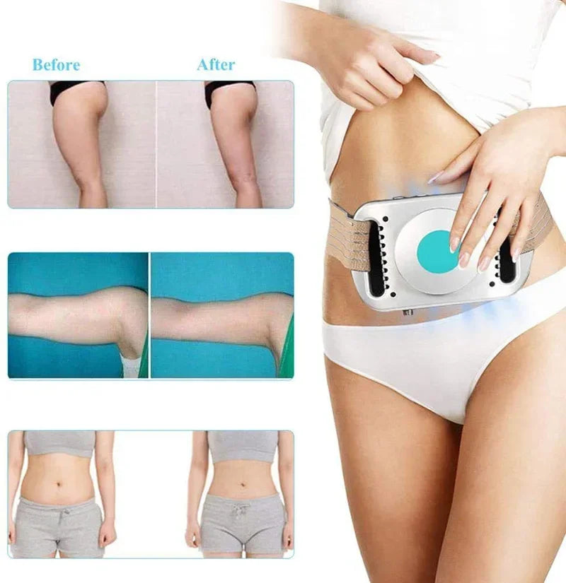 Fat Freezing Slimming Body Belt &ndash; Rotating Abdominal Massage