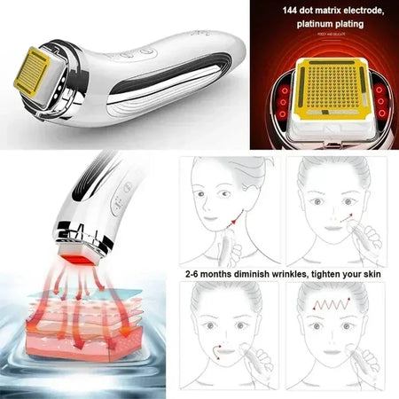 Electric Facial Lifting Machine &ndash; Anti Wrinkle And Lifting