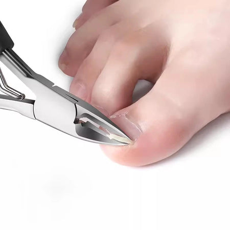 Nail Clipper Set For Ingrown Toenail &ndash; Podiatry Tool