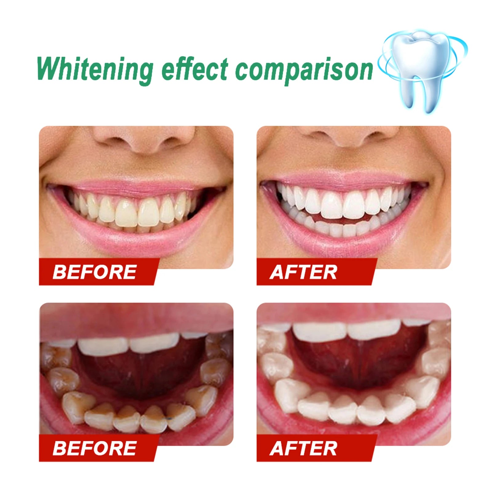5 Days Whitening Tooth Powder &ndash; Effective Stain Removal for Radiant Smile