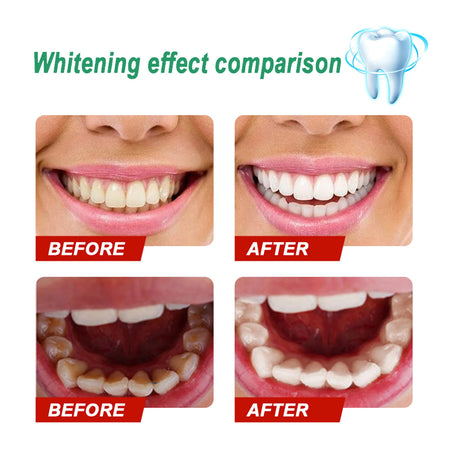 5 Days Whitening Tooth Powder &ndash; Effective Stain Removal for Radiant Smile