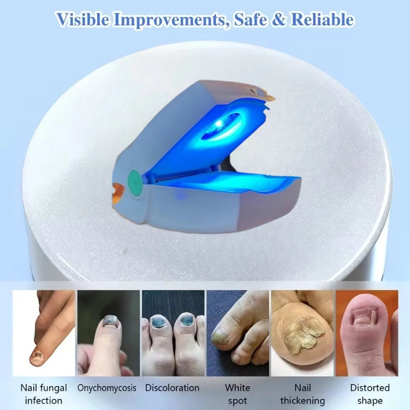 Laserová terapie nehtové plísně s modrým LED světlem pro nehty na nohou