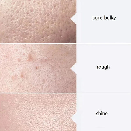 Facial Skincare Serum AS1 SA2 AO3 Aqua Peel Solution &ndash; Glow