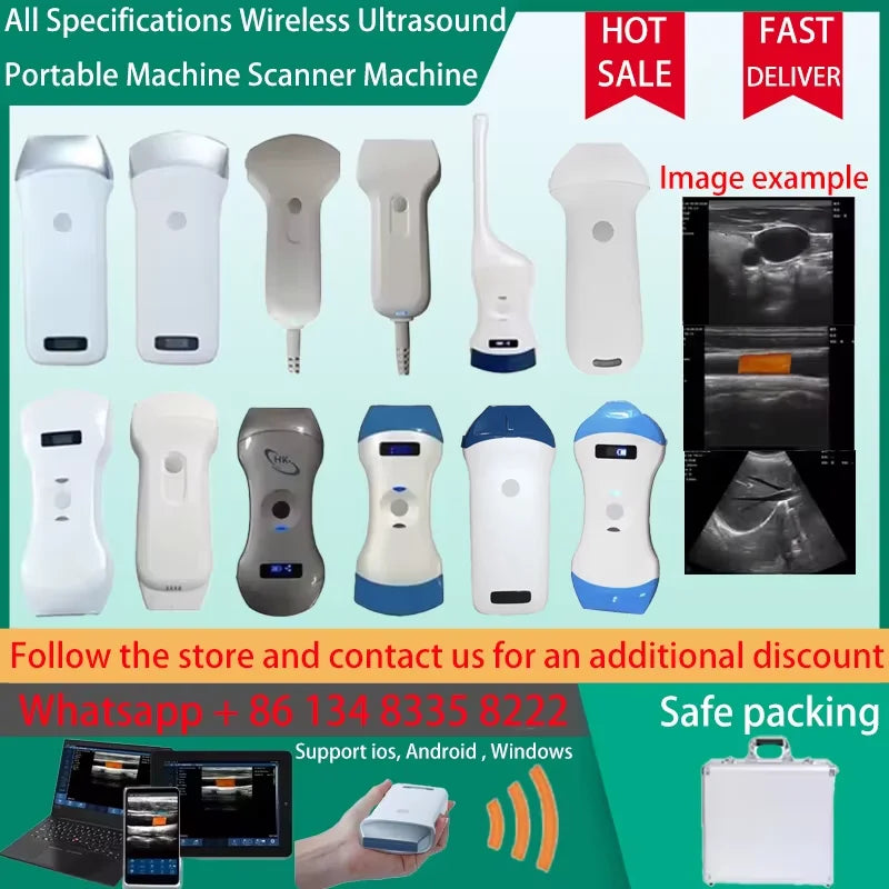 Przenośny bezprzewodowy skaner ultradźwiękowy z WiFi Sonostar