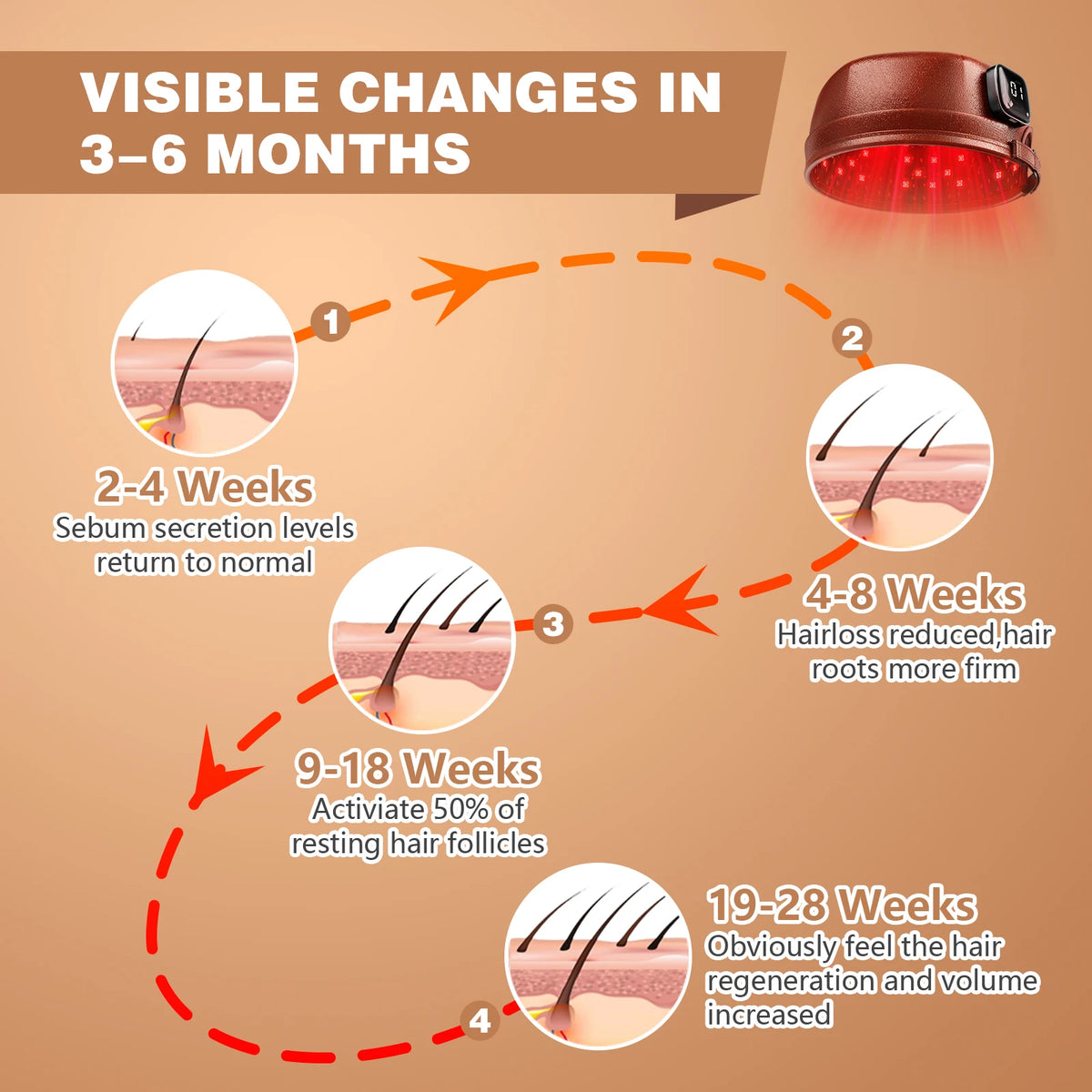 Wireless Hair Growth Cap 120 Diodes &ndash; Lightweight Design