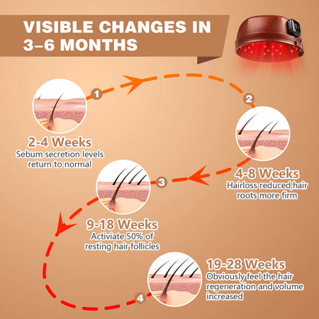 Wireless Hair Growth Cap 120 Diodes &ndash; Lightweight Design