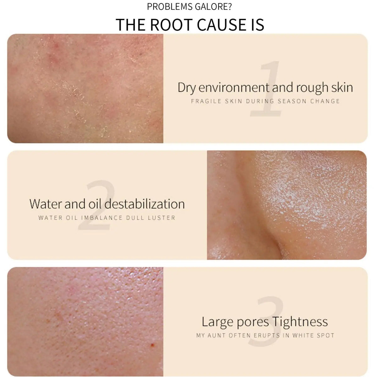 TRSTAY Rice Cream Moisturizer for Pore Shrinking and Anti-Aging