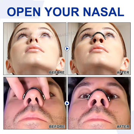 Skin Safe Magnetic Nose Strips &ndash; Boost Oxygen Breathing