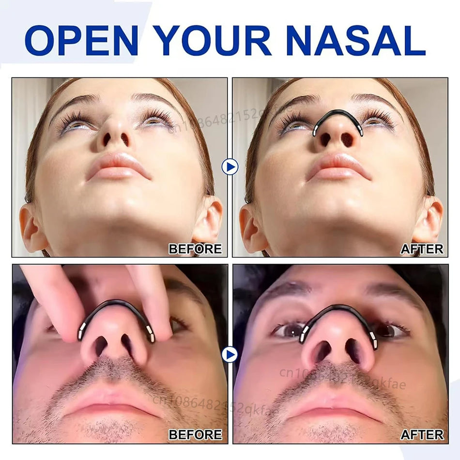 Skin Safe Magnetic Nose Strips &ndash; Boost Oxygen Breathing