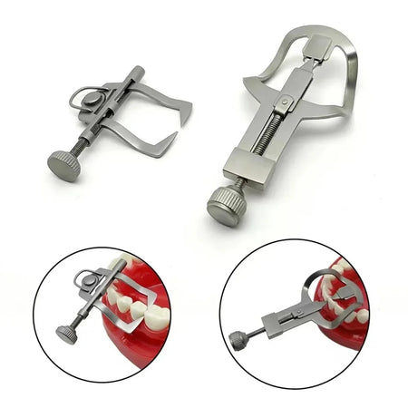 Dental Tooth Separator Wedges &ndash; Superior Precision for Orthodontic Procedures