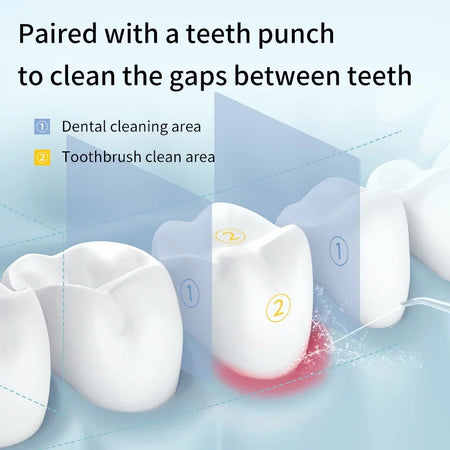 USB Rechargeable Oral Irrigator with 3 Modes &amp; 4 Nozzles | IP65 Waterproof