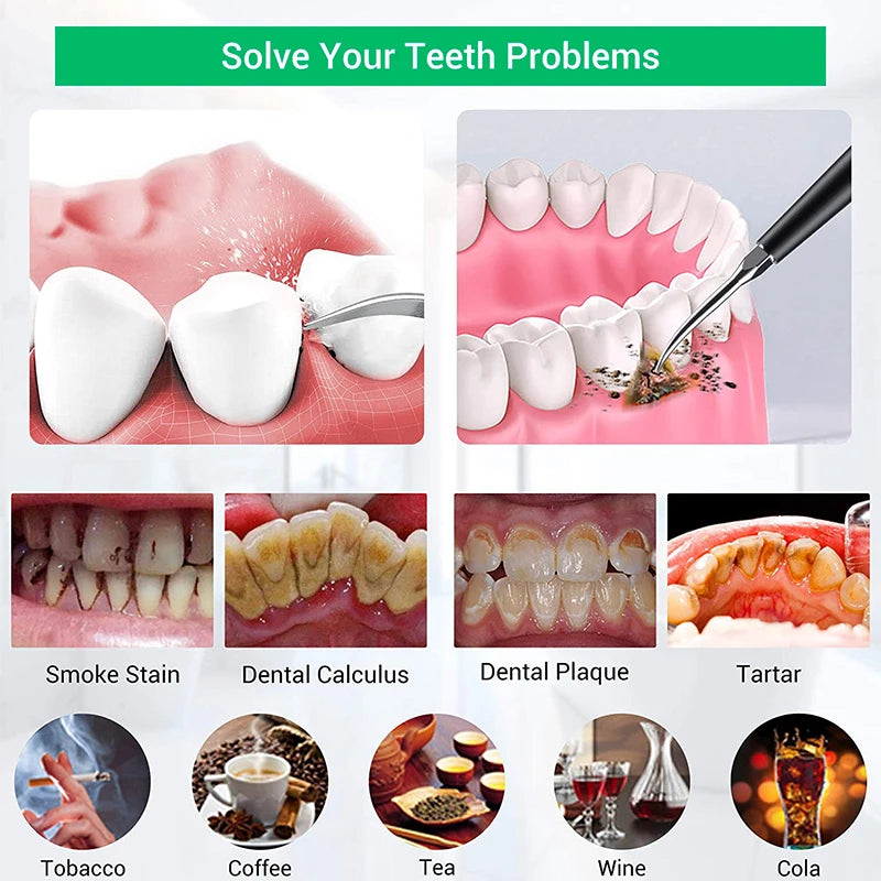 Dental Scaler Ultrasonic Tooth Cleaner &ndash; Advanced Sonic Plaque Removal