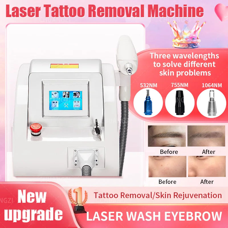 Q Switched Nd Yag Laser Tatoveringsfjernelse Rynkebehandling