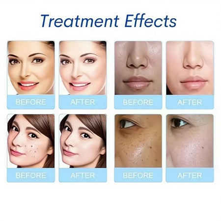 3Pcs Set Serum Aqua Peel Solution &ndash; Deep Clean For Skin