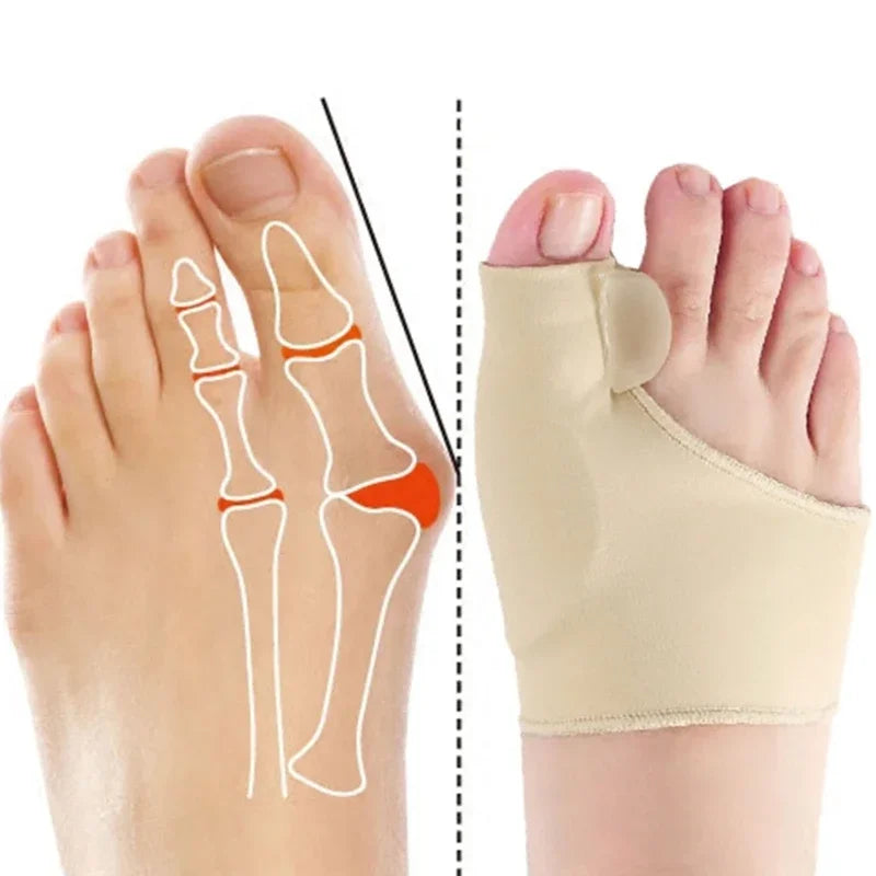 Tåkorrektion Ortoser Silikone Hallux Valgus Retter Sokker