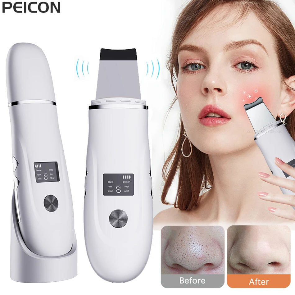 Ultrasonic Facial Scrubber for Deep Cleansing, Pore and Acne