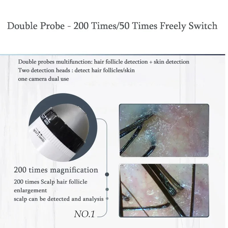 WIFI Scalp Skin Detector 50X200X - HD 5G WiFi Follicle Scan