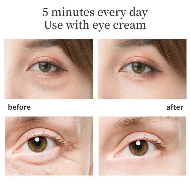 42 &deg;Eye Beauty Device &ndash; EMS Microcurrent Eye Rejuvenation