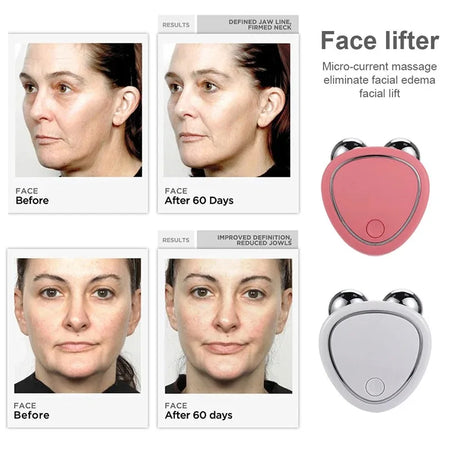 EMS Face Lifting Machine &ndash; Microcurrent Skin Tightening