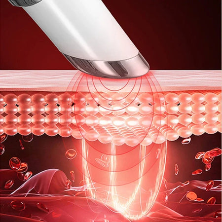 42 &deg;Eye Beauty Device &ndash; EMS Microcurrent Eye Rejuvenation