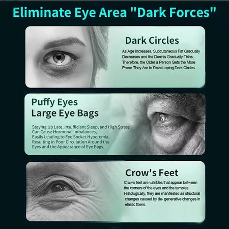 EMS Eye Massager 3D &ndash; 3D Pulse Massage For Fatigue Relief