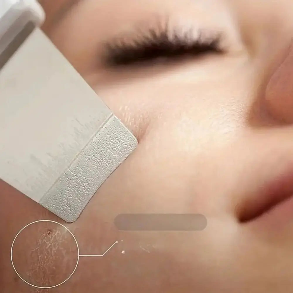 Ultrasonic Skin Scraper - Deep Pore Cleaning Facial Machine for Men &amp; Women