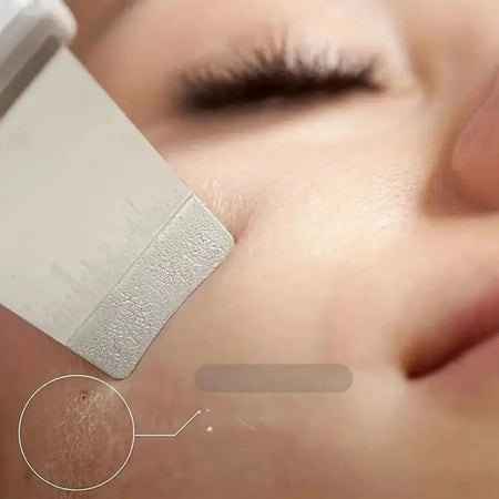 Ultrasonic Skin Scraper - Deep Pore Cleaning Facial Machine for Men &amp; Women