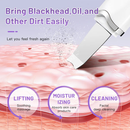 Electric Ultrasonic Skin Scrubber - Blackhead Remover &amp; Facial Lifting Tool