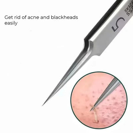 German Ultra-fine Blackhead Clip Tweezers | Professional Beauty Tool