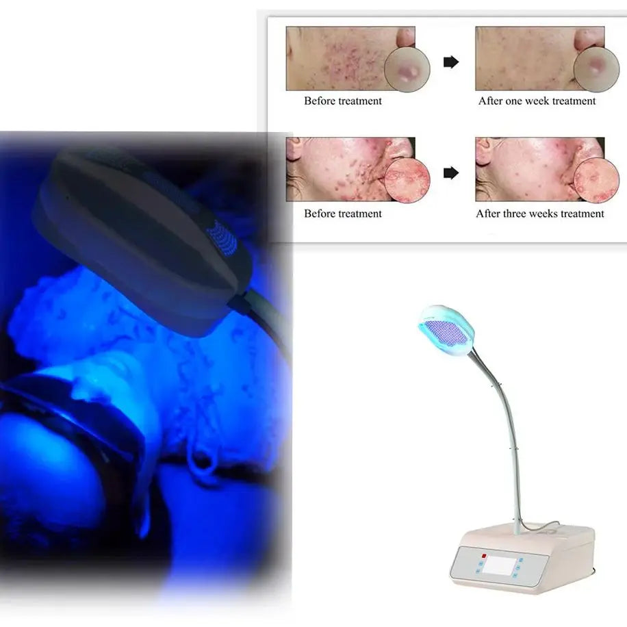 Επαγγελματική μάσκα φωτεινής θεραπείας LED για ουλές ακμής και ρυτίδες