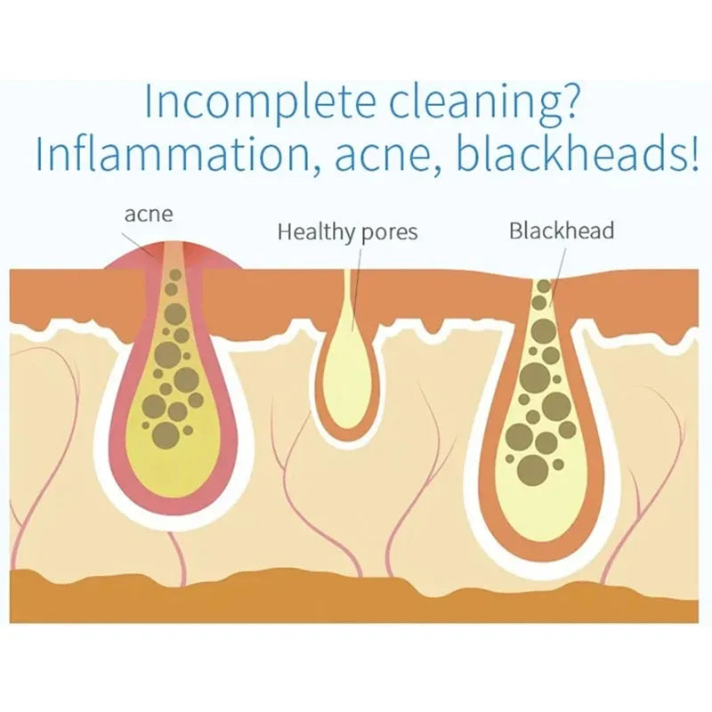 NEW Peeling Beauty Device &ndash; Bubble Oxygen Injection