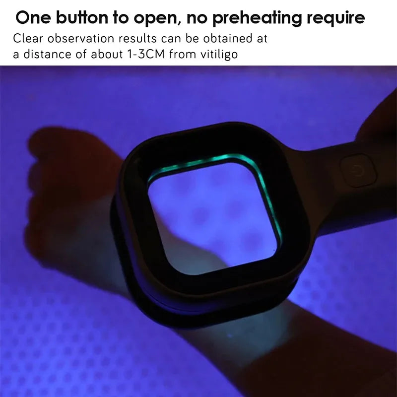 Woods Lamp Skin Examination - Pet Skin Ultraviolet Detector