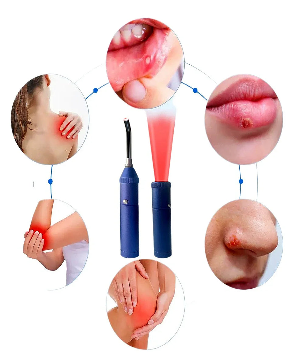 Laser Infravermelho Portátil para Rejuvenescimento da Pele e Tratamento de Acne para Uso Doméstico