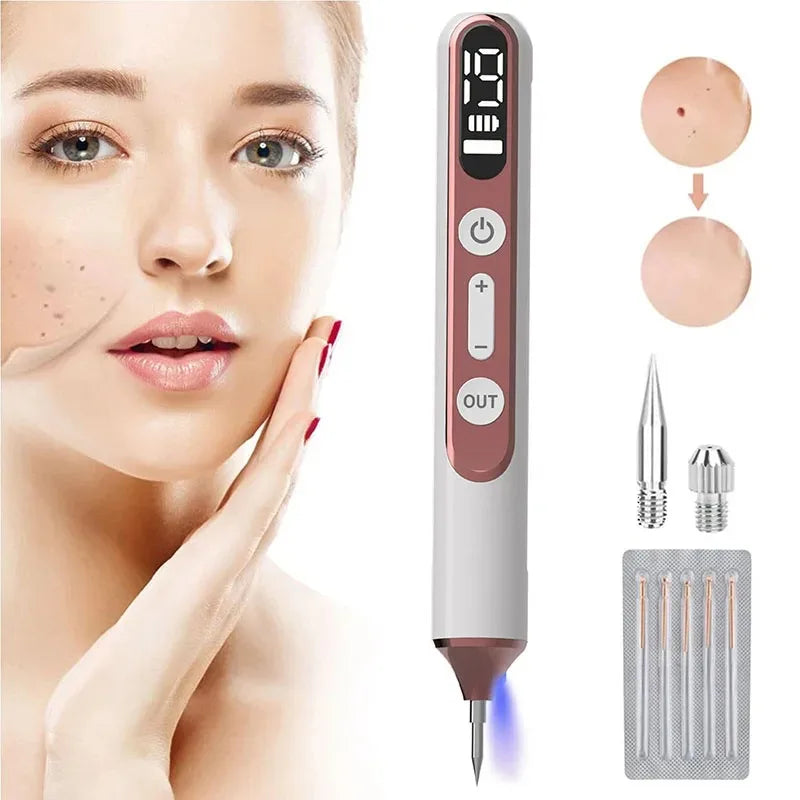 Skin Tag Remover Laser Plasma Pen &ndash; Warts Eliminator
