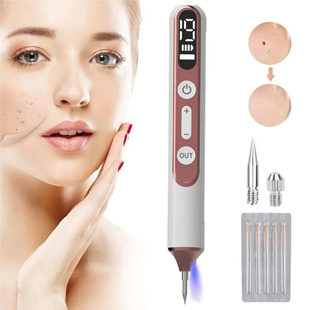 Skin Tag Remover Laser Plasma Pen &ndash; Warts Eliminator