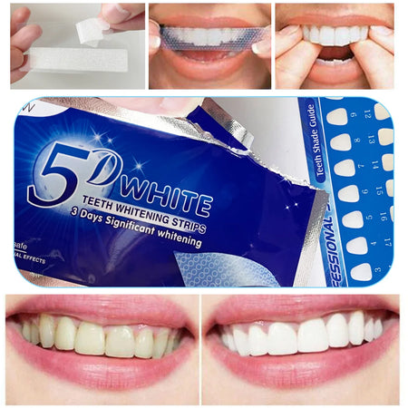 5D Gel Teeth Whitening Strips &ndash; Effective Whitening for False Teeth and Veneers
