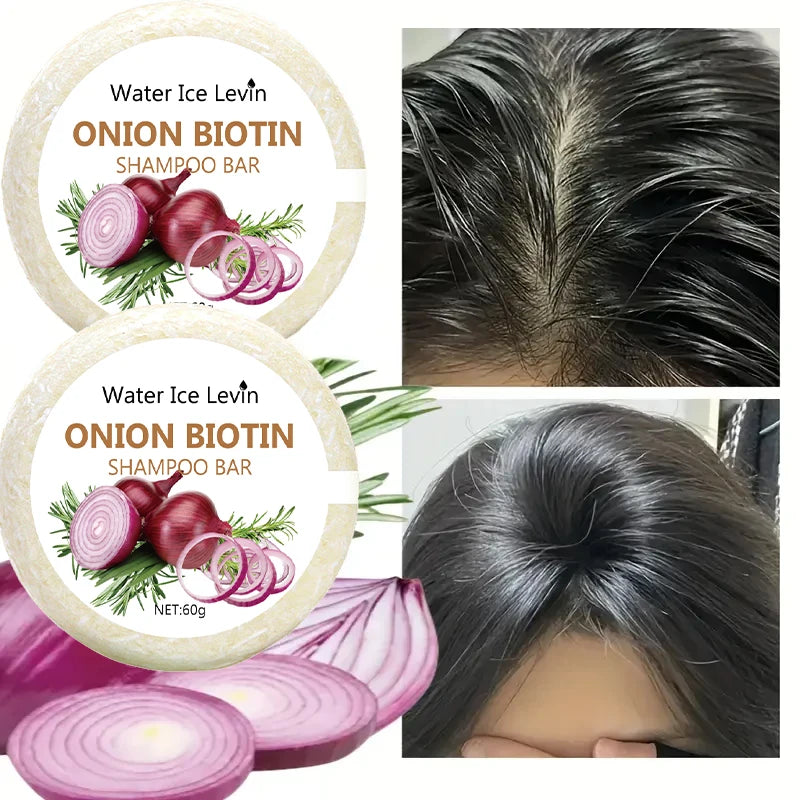 Onion and Biotin Shampoo Soap &ndash; Moisturizing and Smoothing Formula