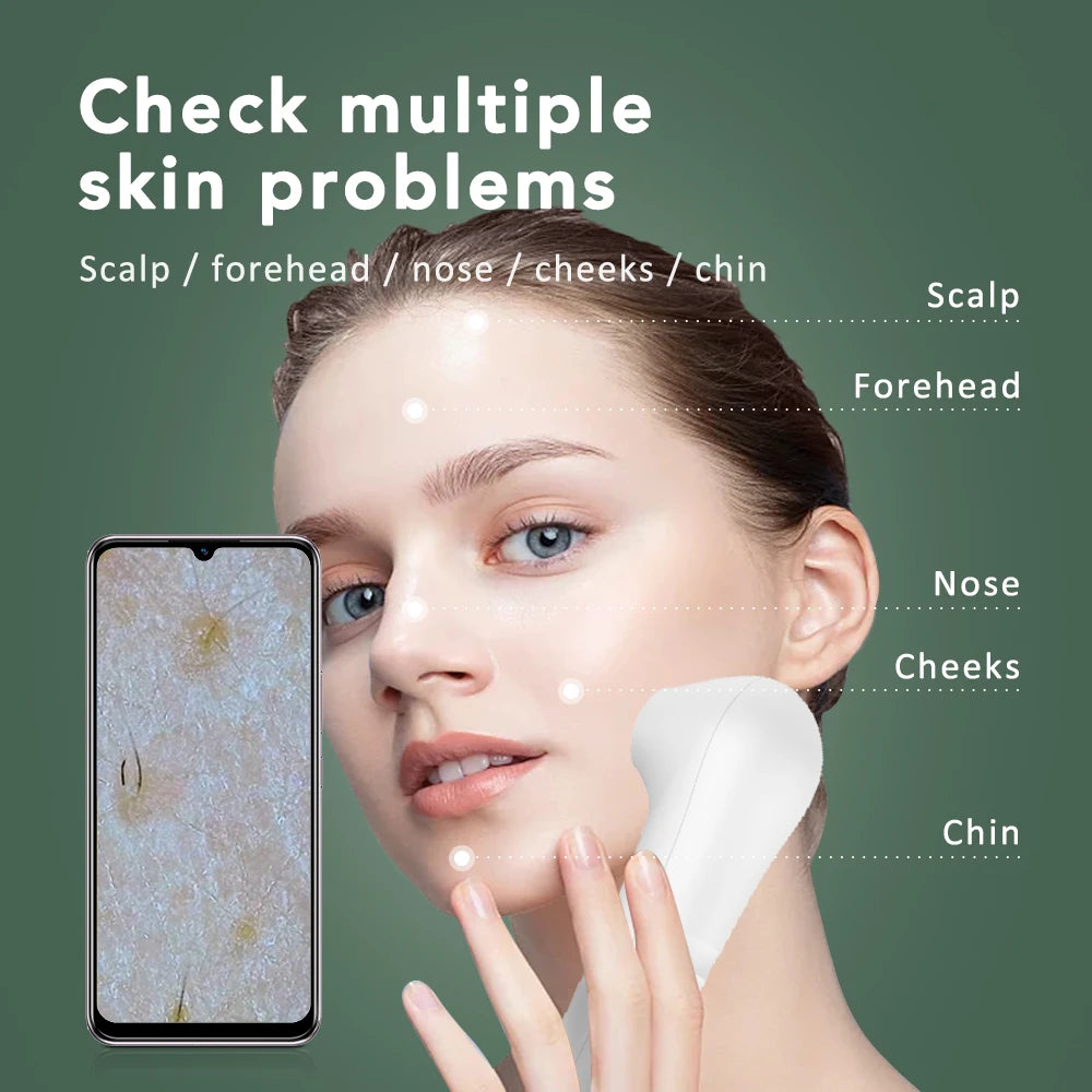 Skin Analyzer Dermatoscope &ndash; Ultra Clear Imaging Tech
