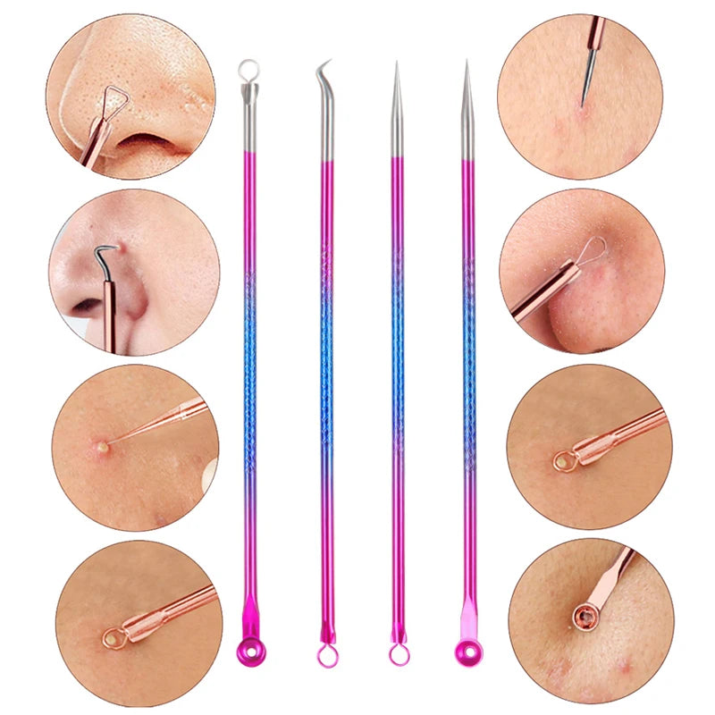 4PCS Acne &amp; Blackhead Remover Needle Hook | Skin Care Tool
