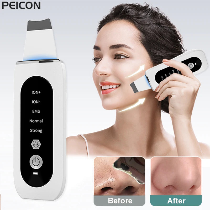 Ultrasonic Skin Scrubber For Deep Facial Cleansing, Blackhead And Pore Cleaner
