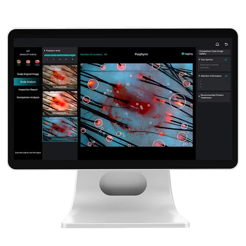 UV Skin Analyzer 15 Inch Pro Ανιχνευτής Κεφαλής Τριχοθυλάκων