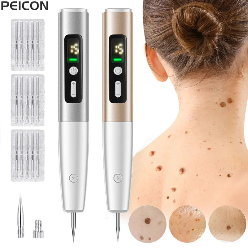 Laser Plasma Pen for Mole, Wart, Freckle, Skin Tag, and Dark Spot Removal