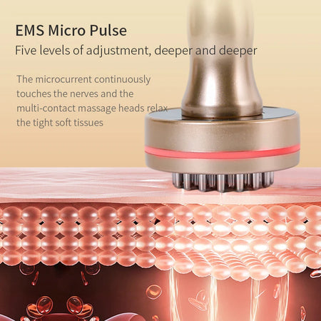 Microcurrent Cellulite Massager &ndash; Heating Vibration