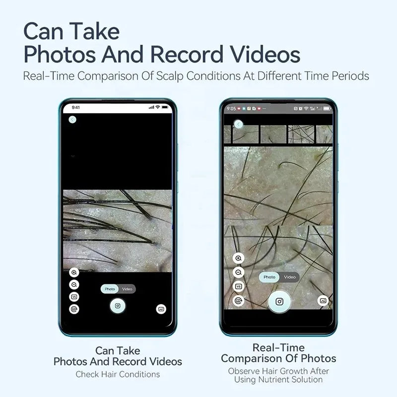 Electron Dermatoscope Scalp Camera &ndash; Facial Skin Analysis