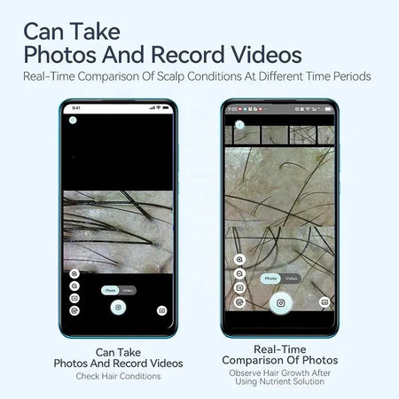 Electron Dermatoscope Scalp Camera &ndash; Facial Skin Analysis