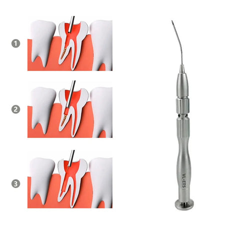 Dental Endodontic Endo File Kit &ndash; Root Canal File Remover