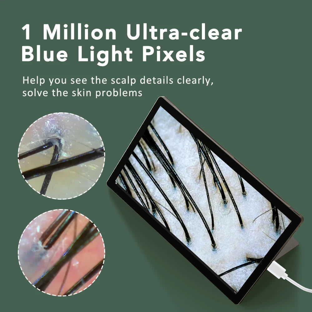 Skin Analyzer Dermatoscope &ndash; Ultra Clear Imaging Tech